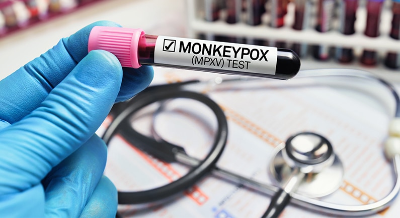 Rapid Testing Breakthrough: Detecting Mpox Through Molecular Sensors