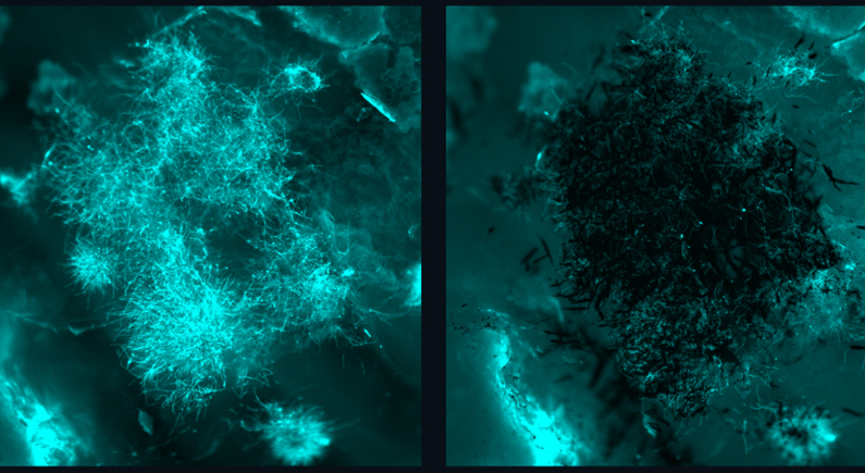 Pennsylvania Researchers Develop Magnetic Nanorobots for Selectively Eliminating Infective Fungal Species