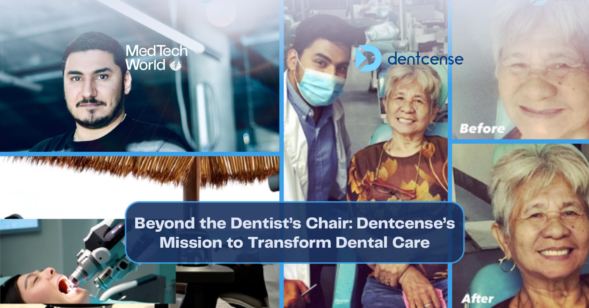 Dentcense