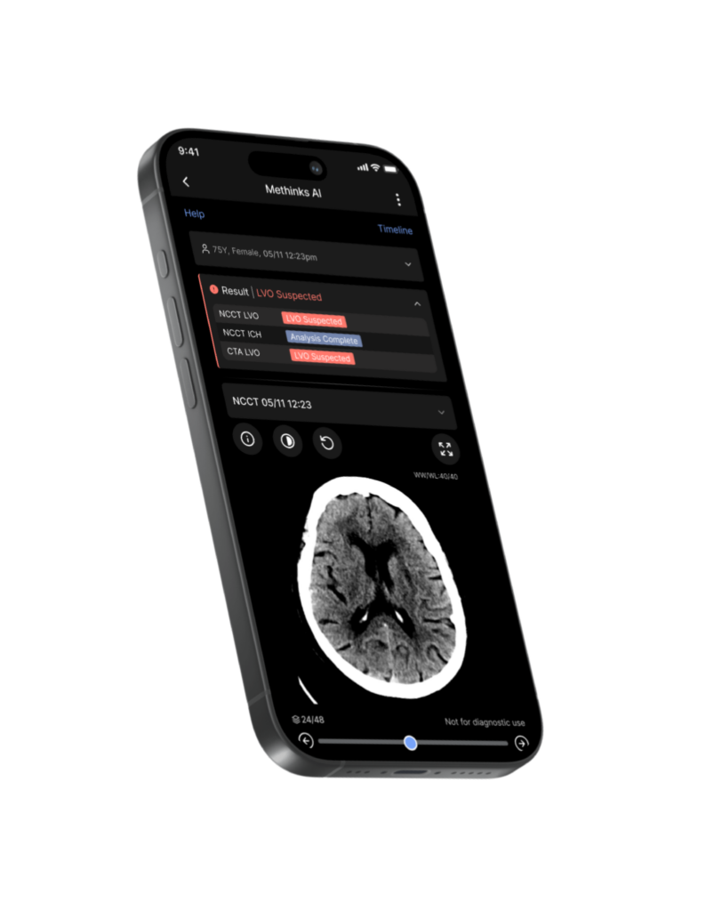 Methinks AI image viewer helps review patient imaging with advanced tools