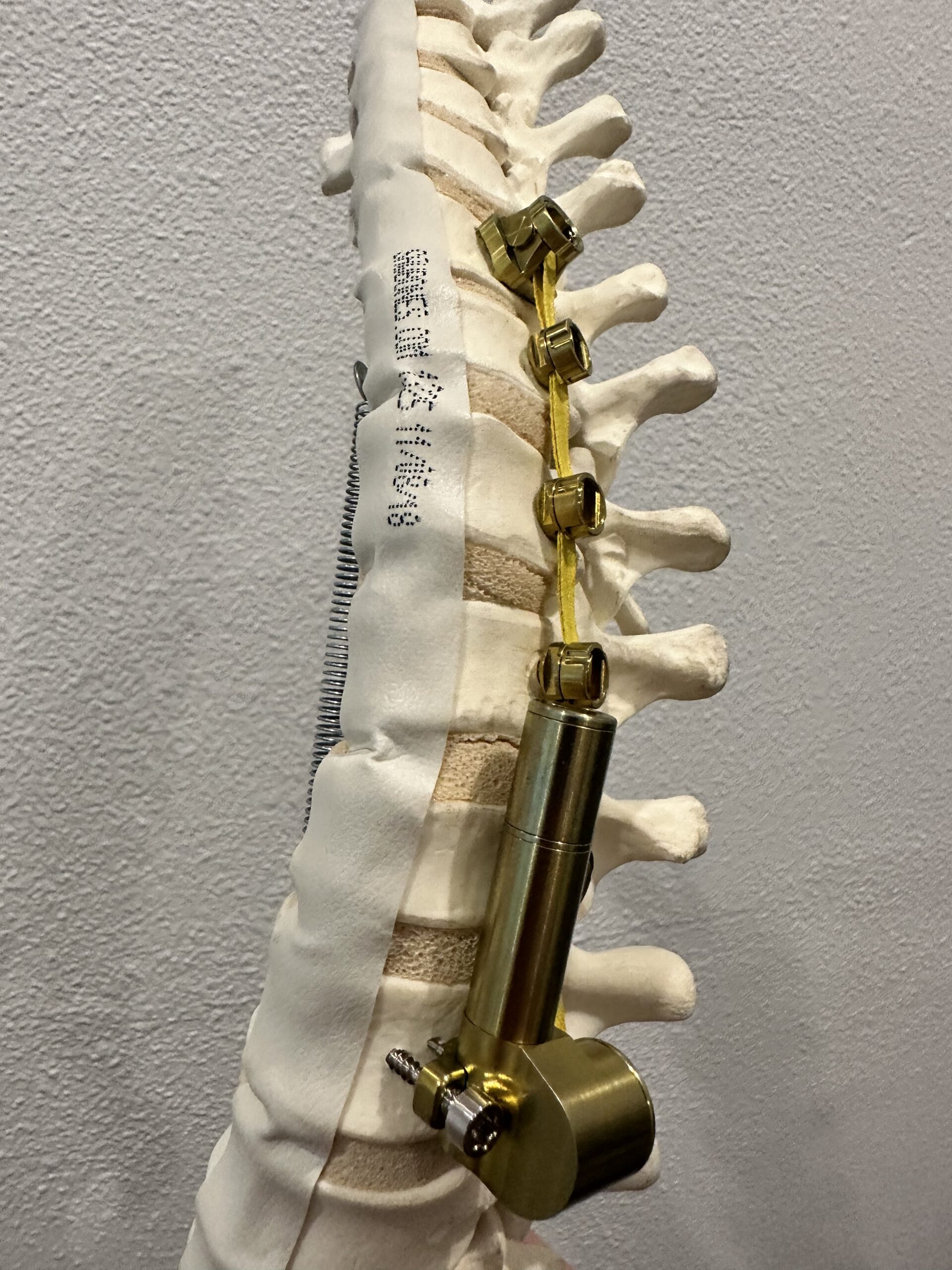 One of the products by Auctus Surgical