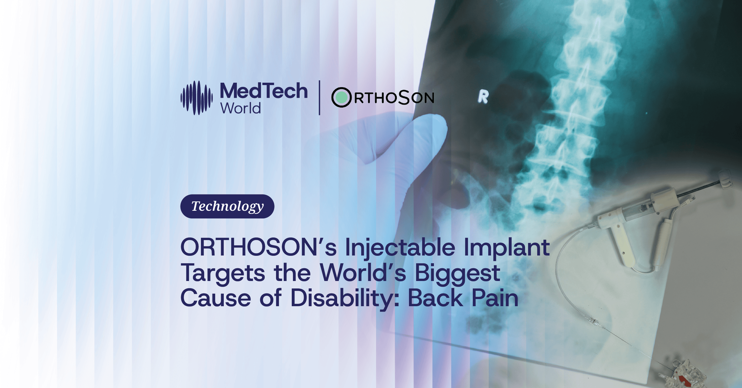 ORTHOSON’s injectable implant targets the world’s biggest cause of disability: Back pain 