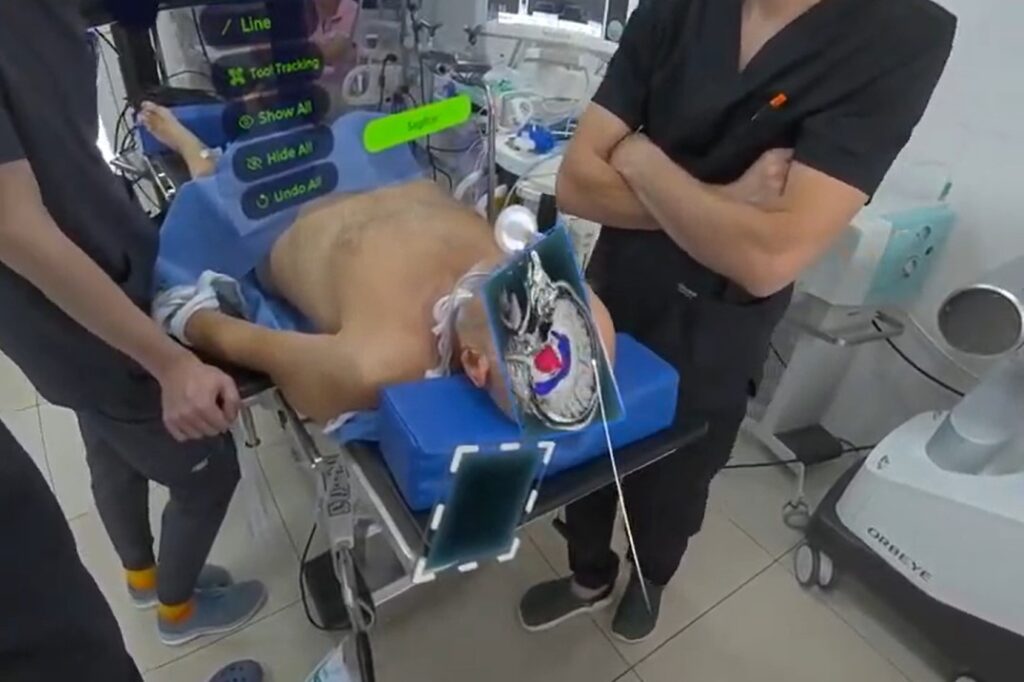This image shows a first-person view of an operating room with the eXtra Vision surgical-intelligence platform active during cranial surgical planning. The screenshot captures the “slicing” of a 1:1 3D model of the patient’s head, generated from AI-driven segmentation of 2D PACS/DICOM images, visualizing full-body 3D/spatial anatomy with highlighted pathology.